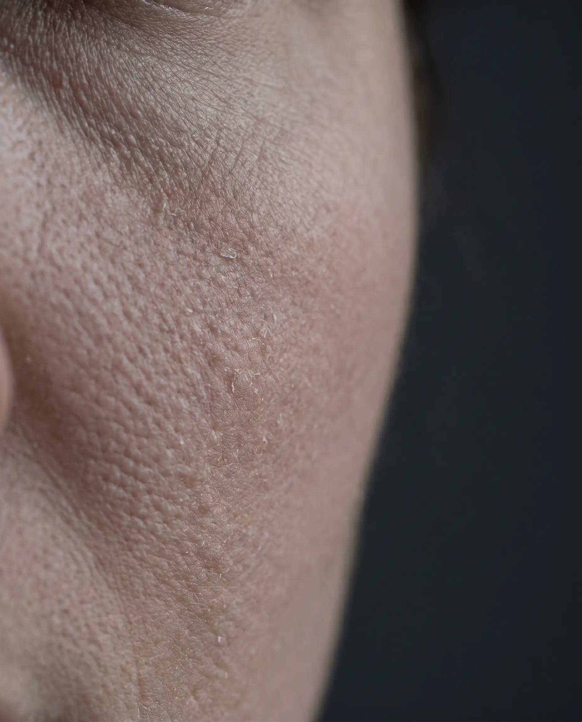Close-up of facial skin showing flat, low-luminosity surface texture